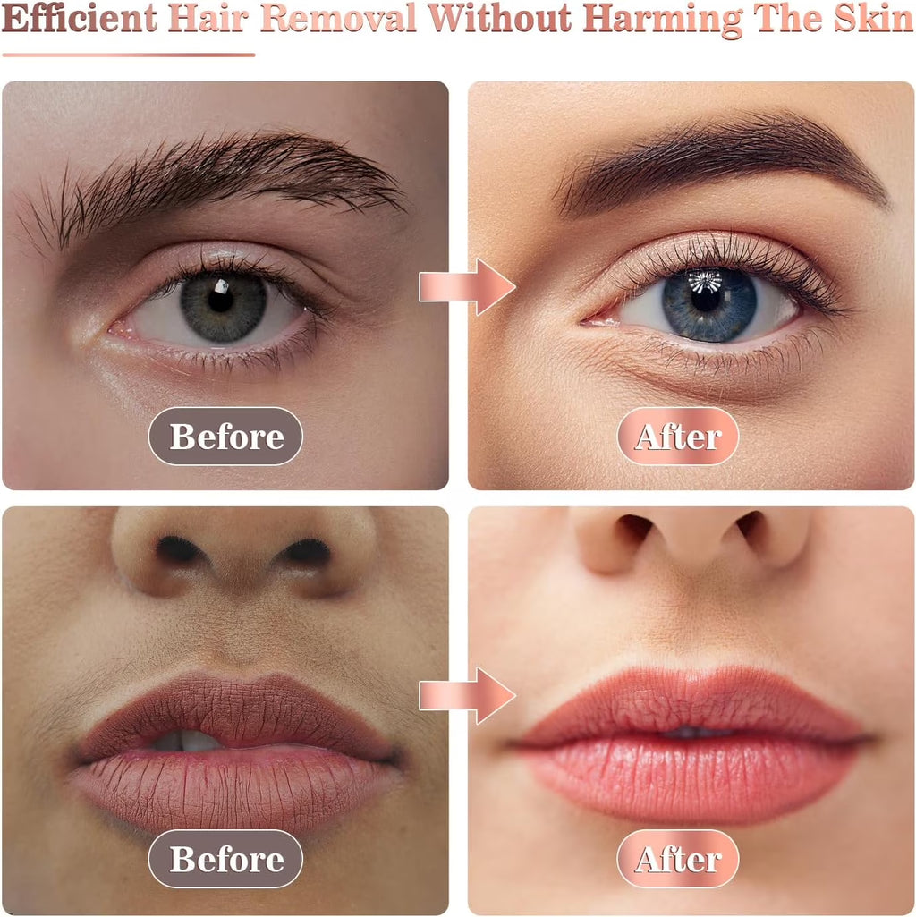 Facial Hair Remover for Women - Painless Face Shaver - Electric Hair Removal Device for Face Lips Peach Fuzz with Light (Whtie)